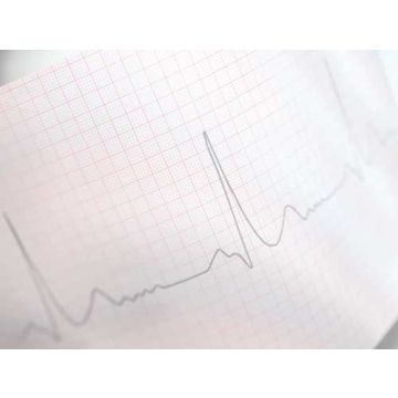 Z-fold Paper for Cardisuny Alpha ECG