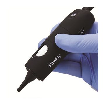 Firefly Wired USB Otoscope DE500