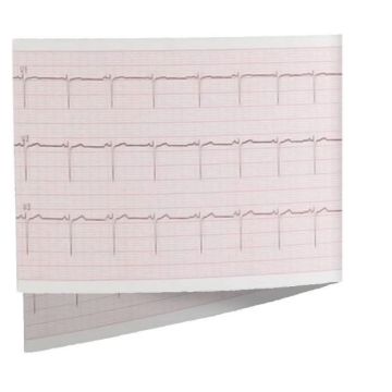 Seca ECG Paper for Seca Cardio (5 Pack)