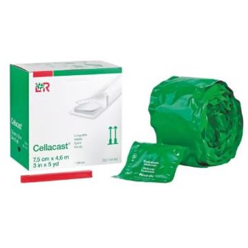 Rolled Splint - Backslab