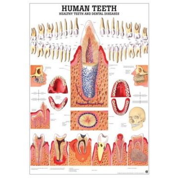 Rüdiger Anatomie Healthy & Diseased Human Teeth Chart