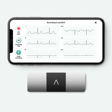 6 Lead AliveCor Kardia Mobile 6L ECG for iPhone and Android