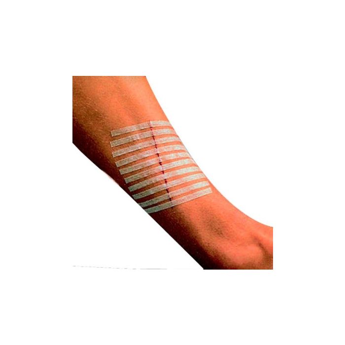3M Steri-Strip Skin Closures, 12mmx100mm (50 Pack - 300 strips)