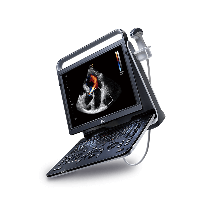 Chison Ebit 60 (device + phased array probes one for adult another for pediatric ）+trolley