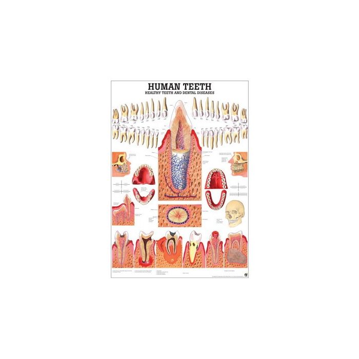 Rüdiger Anatomie Healthy & Diseased Human Teeth Chart