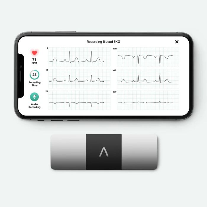 6 Lead AliveCor Kardia Mobile 6L ECG for iPhone and Android